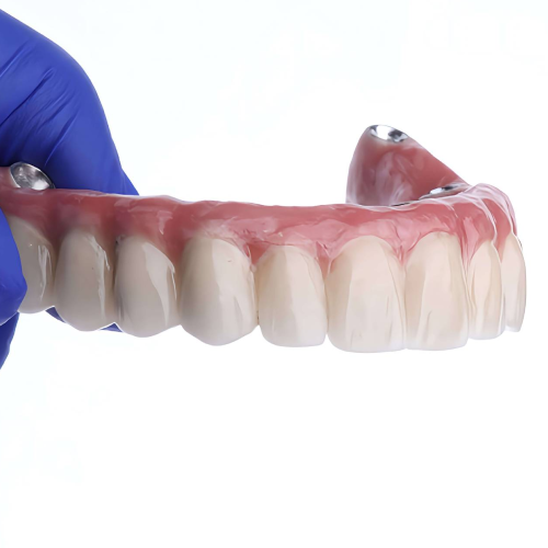 Full-arch implant hybrid prosthesis by LexaDent Studio