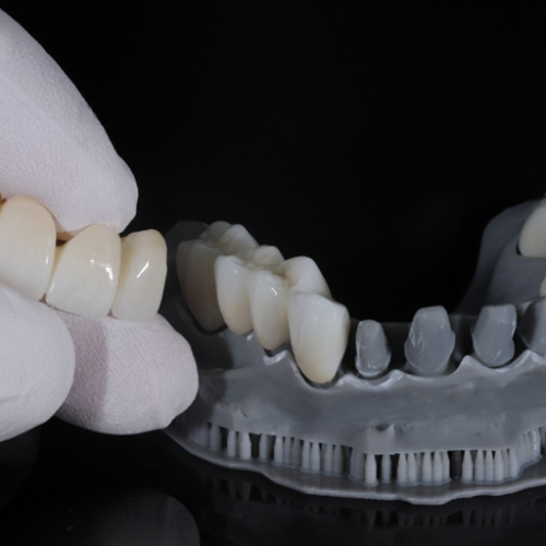 High-strength zirconia dental restorations by LexaDent Studio