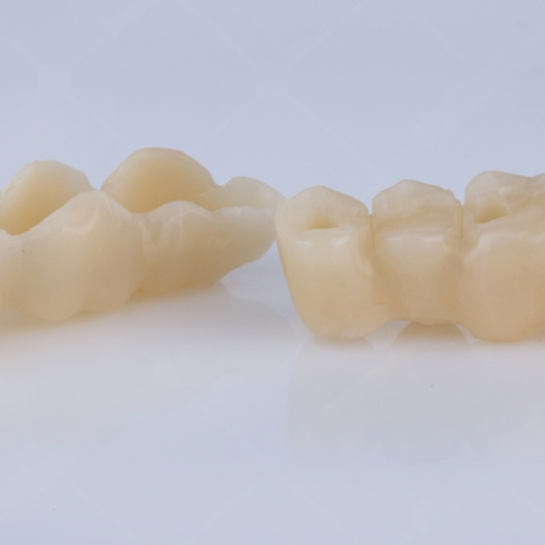 Custom provisional dental restorations by LexaDent Studio